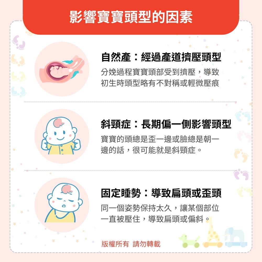 影響寶寶頭型的因素